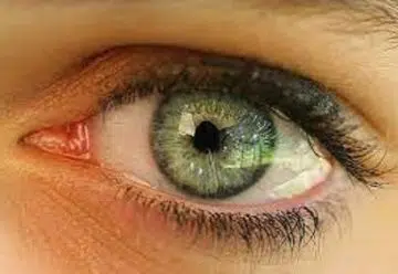 Yeux vitreux les causes et traitements